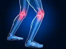 joint replacement academy